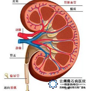 艾灸治好胆结石的原理_胆结石可怕吗 艾灸能把胆结石灸成泥沙状(3)