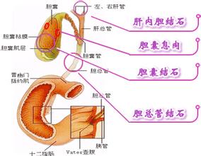 肾结石不能吃什么海鲜_肾结石吃什么药好_银霄病什么不能吃(4)