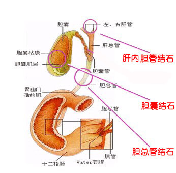 106-150G50U225100.jpg